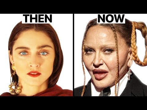 Madonna Plastic Surgeries – Surgeon Reacts