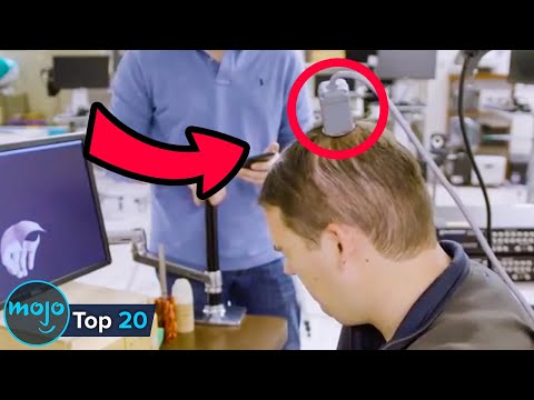 Top 20 Facts About Brain Implants