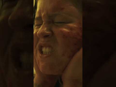 When the itch has indeed been scratched 😵‍💫🩸💀. Watch “Dead Skin” on #ALTER! #shorts #shortfilm