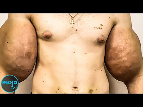 Top 10 Plastic Surgery Nightmares